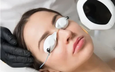 IPL Luz Pulsada Intensa: Precisión avanzada en tratamientos estéticos