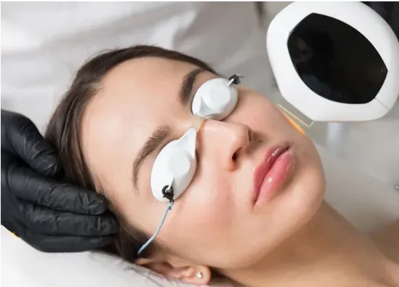 IPL Luz Pulsada Intensa: Precisión avanzada en tratamientos estéticos